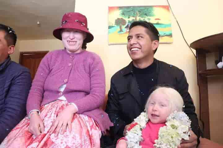 Albinismo en Bolivia