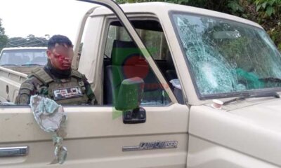 Policía herido
