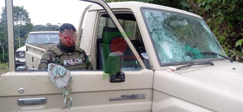 Policía herido